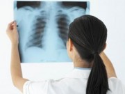 Sức khỏe - Bệnh nào gây tử vong hàng đầu thế giới?