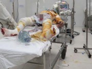 Tin tức - Chồng mua xăng tưới lên người rồi ôm vợ tự thiêu