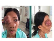 Tin tức - Chuyện người đàn bà ‘mọc thêm đầu’ trên mặt
