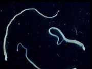 Tin tức - Sán dây bị ung thư truyền bệnh khiến người mất mạng