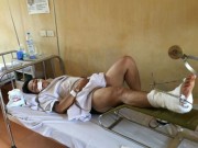 Tin tức - Phút kinh hoàng trên nắp ca-pô taxi gây tai nạn ở cầu vượt