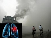 Tin tức - Ung thư phổi gia tăng, số người mắc bệnh ngày càng trẻ hóa