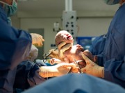 Bà bầu - Lời khuyên 'vàng' mẹ nào cũng cần biết trước khi đẻ mổ