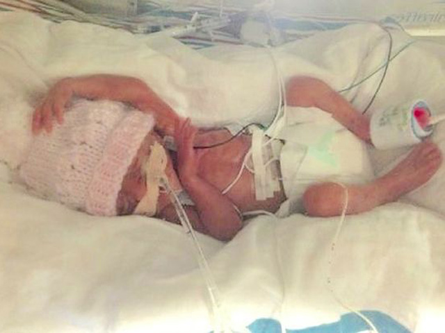 Bà mẹ kể lại giây phút kinh hoàng khi sinh non 23 tuần