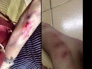 Tin tức - Thực hư cô gái trẻ "tố" bị cướp tấn công trong đêm ở HN