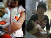 Làm mẹ - Bé 1 tuổi bị đũa đâm xuyên miệng vì thói bất cẩn của người lớn