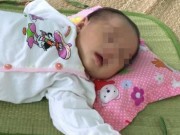 Tin tức - Điều trị thành công bệnh nhi tiểu đường sơ sinh do đột biến gen