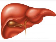 Sức khỏe - Đừng để viêm gan làm giảm chất lượng sống