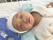 Làm mẹ - Bé sơ sinh bị đũa chọc vào mắt vì một phút lơ là của mẹ