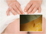 Làm mẹ - HN: Bé gái bị dị vật lọt vào âm đạo khiến người nhà tá hỏa