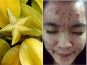 Làm đẹp - 1 quả khế chua - 2 cách làm đẹp tốt hơn cả kem trị mụn đắt tiền