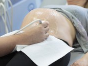 Bà bầu - Siêu âm nhiều lần có gây dị tật thai nhi?