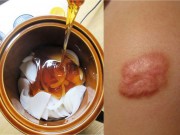 Làm đẹp - Những mẹo làm đẹp "hữu ích" không thể bỏ lỡ từ hành tây