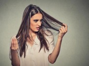 Tin tức - Mắc chứng nghiện ăn tóc, người phụ nữ có búi tóc khổng lồ trong dạ dày