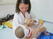 Tin tức - Bé gái 2 tuổi bị lột toàn bộ da đầu vì tai nạn giao thông