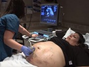 Bà bầu - Mới mang bầu đã thấy nhiều vết thâm tím, bà mẹ ‘sốc nặng’ khi nhận tin từ bác sĩ