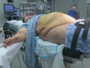 Bà bầu - Bà mẹ nặng 200kg và ca sinh mổ khiến bác sĩ như “ngồi trên đống lửa”