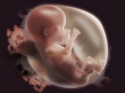 Bà bầu - 10 việc mẹ cần làm để giảm nguy cơ thai nhi bị dị tật