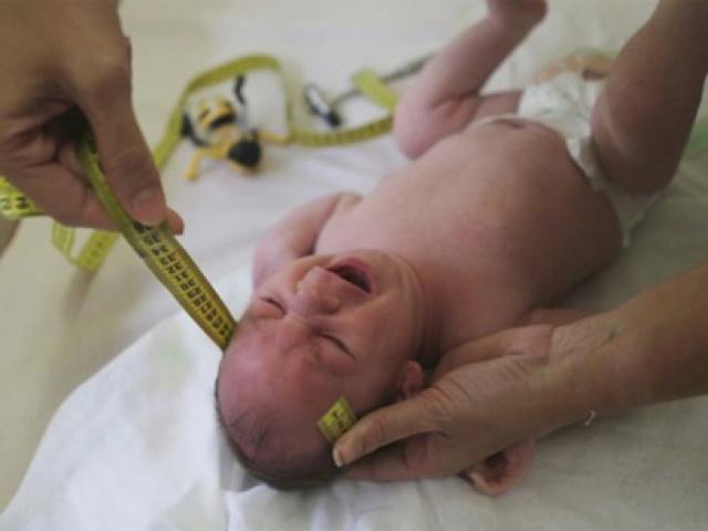 Liên tiếp phát hiện thêm trẻ mắc dị tật đầu nhỏ nghi do virus Zika ở Việt Nam