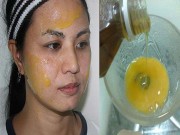 Làm đẹp - 3 loại mặt nạ giúp bạn chặn đứng nám tàn nhang, không lo tái phát