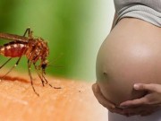 Tin tức - Phụ nữ chuẩn bị mang thai nên cân nhắc trước tình hình dịch Zika