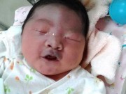 Bà bầu - Mẹ sinh con mặt mũi thâm tím vì thói quen ăn uống này trong thai kỳ