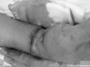 Tin tức - Chém đứt lìa tay vợ trước sân tòa