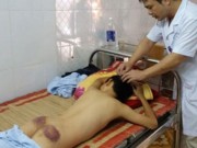 Tin tức - Bé trai 12 tuổi bị mẹ kế dùng chày đánh trọng thương phải nhập viện