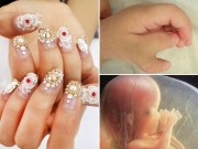 Bà bầu - Làm móng lúc mang thai 3 tháng, mẹ đau đớn khi nhìn ảnh siêu âm thai