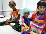 Tin tức - Ám ảnh thiếu nữ 18 tuổi bị suy dinh dưỡng, thân thể chỉ còn nhúm xương