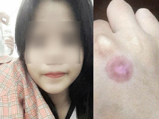Nữ sinh bị đánh hội đồng vì khen người yêu đồng tính của bạn 'cười dễ thương'