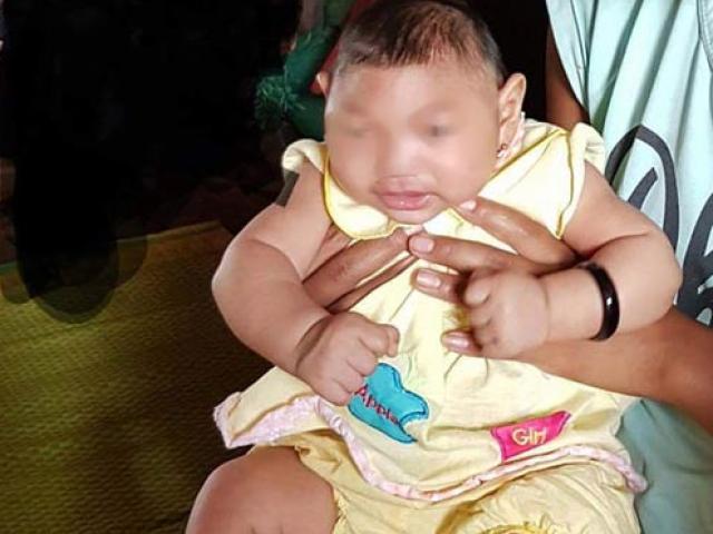 Bộ Y tế xác nhận em bé Việt Nam đầu tiên mắc chứng đầu nhỏ do virus Zika