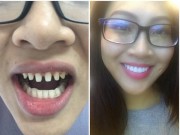 Thời trang - Hoa khôi Diệu Ngọc bị lộ loạt ảnh phẫu thuật thẩm mỹ