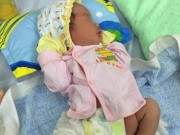 Tin tức - Bác sỹ mổ lấy thai, một bé sơ sinh bị gãy xương đùi