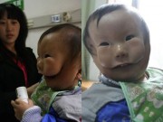 Bà bầu - Siêu âm đều đặn, bà mẹ trẻ vẫn khóc nghẹn khi sinh con “2 mặt”