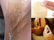 Làm đẹp - 2 công thức từ nhựa hồng xiêm giúp bạn tẩy lông hiệu quả bất ngờ