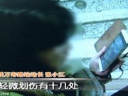 Tin tức - Cô gái ngã xuống 30 bậc thang nhưng việc đầu tiên khi ngồi dậy là kiểm tra điện thoại
