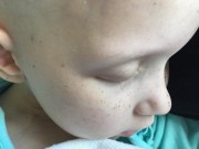 Tin tức - Sợi lông mi cuối cùng của bé gái mắc bệnh ung thư khiến nhiều người phải bật khóc