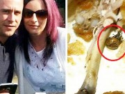 Tin tức - Thai phụ 7 tháng bị ngộ độc suốt 3 ngày vì ăn món gà rán có xác nhện