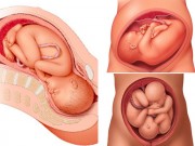 Bà bầu - "Ngó" bụng mẹ xem vị trí nằm của thai nhi ngay trước khi chào đời