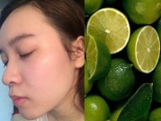Làm đẹp - Thổi bay mụn trứng cá, sẹo thâm lâu năm chỉ bằng loại quả ai cũng biết