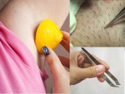 Làm đẹp - Cách diệt tận gốc lông nách mọc li ti ngứa ngáy bằng hỗn hợp rẻ bèo