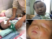 Bà bầu - Những ca ‘siêu âm thai bình thường, sinh con dị dạng’ khiến cha mẹ chết lặng