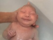 Làm mẹ - Bé gái chào đời với phần đầu thiếu não khiến y học kinh ngạc vì nghị lực sống