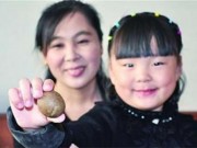 Tin tức - Mổ cừu làm thịt, bất ngờ phát hiện viên sỏi lạ trị giá tiền tỷ