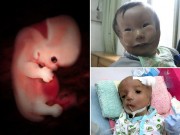 Bà bầu - Làm đúng những việc này, mẹ bầu sẽ không lo ‘siêu âm bình thường, sinh con dị tật’