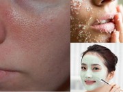 Làm đẹp - Lỗ chân lông không bao giờ to trở lại khi đã thuộc lòng 6 mẹo này