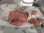 Bà bầu - Mang thai khỏe mạnh, mẹ trẻ 'khóc ngất' khi thấy con thế này sau sinh mổ