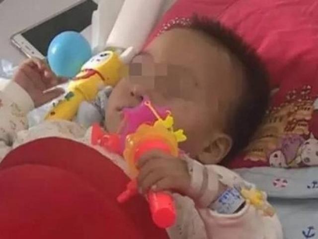 Người lớn sơ sẩy, chị 3 tuổi khiến em 2 tuổi bị liệt nửa người và cắt bỏ thận phải
