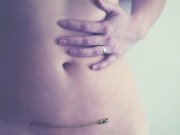 Bà bầu - Vết sẹo mổ lấy thai và những điều ít ai nói cho mẹ bầu biết